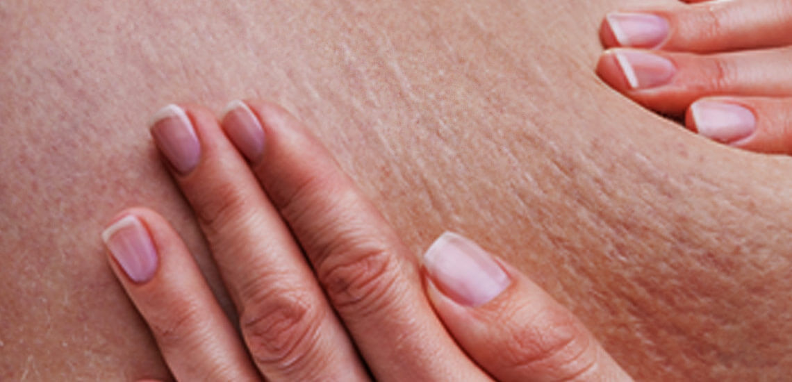 کلینیک پوست و مو- مزوتراپی لاغری