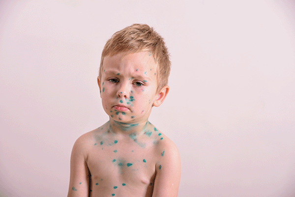 حساسیت پوست کودک