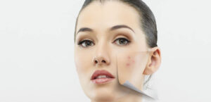 درمان جوش صورت پس از اصلاح